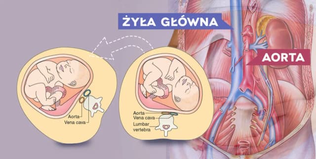 Jak ułożyć kobietę w ciąży w pozycji bezpiecznej, by uratować życie